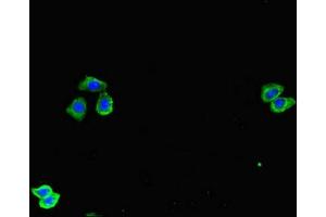 Immunofluorescence (IF) image for anti-Sparc/osteonectin, Cwcv and Kazal-Like Domains Proteoglycan (Testican) 1 (SPOCK1) (AA 290-435) antibody (ABIN7171790)