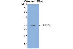 Western Blotting (WB) image for anti-Alcohol Dehydrogenase 1 (Class I) (ADH1) (AA 25-228) antibody (ABIN1857916) (ADH1 抗体  (AA 25-228))