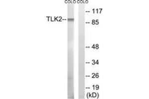 Western blot analysis of extracts from COLO cells, using TLK2 Antibody. (TLK2 抗体  (AA 191-240))