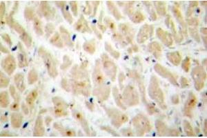 Immunohistochemistry (IHC) analyzes of MAPKAPK-2 antibody in paraffin-embedded human heart tissue. (MAPKAP Kinase 2 抗体)