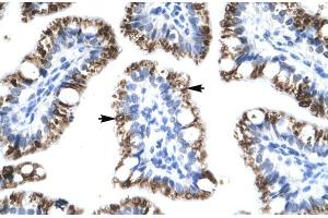 Immunohistochemistry (IHC) image for anti-Activating Transcription Factor 2 (ATF2) (C-Term) antibody (ABIN2778291)