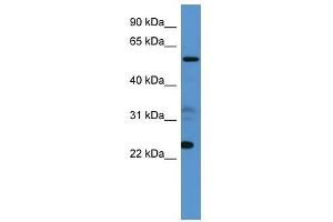 Western Blot showing CPNE9 antibody used at a concentration of 1-2 ug/ml to detect its target protein. (CPNE9 抗体  (C-Term))