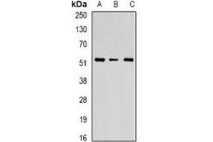 Western blot analysis of Chitotriosidase expression in U251 (A), HEK293T (B), mouse spleen (C) whole cell lysates. (Chitotriosidase 1 抗体)