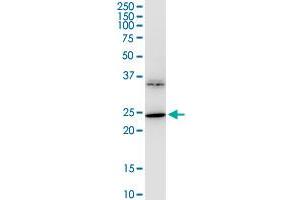 BDNF monoclonal antibody (M02), clone 1B10. (BDNF 抗体  (AA 1-247))