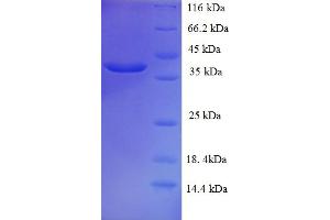 Mucin 2, Oligomeric Mucus/gel-Forming (MUC2) (AA 36-240) protein (His-SUMO Tag)
