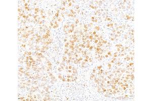 anti-CCAAT/enhancer Binding Protein (C/EBP), beta (CEBPB) (AA 50-100) antibody