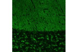 Indirect immunostaining of PFA fixed cerebellum sections (dilution 1 : 500). (SHANK3 抗体  (AA 1055-1616))