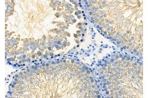 ABIN6265420 and ABIN6278637 at 1/100 staining Rat testis tissue by IHC-P. (TAAR3 抗体  (Internal Region))