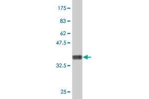 Western Blotting (WB) image for anti-Zinc Finger Protein 622 (ZNF622) (AA 1-100) antibody (ABIN529996)