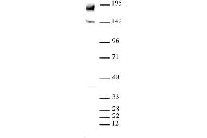 PBRM1 (pAb) tested by Western blot. (Polybromo 1 抗体  (N-Term))