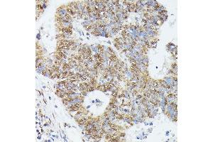 Immunohistochemistry (IHC) image for anti-Kinesin Family Member 22 (KIF22) (AA 456-665) antibody (ABIN7268129)