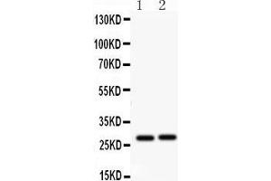 Western Blotting (WB) image for anti-Insulin-Like Growth Factor Binding Protein 1 (IGFBPI) (AA 177-207), (C-Term) antibody (ABIN3042732) (IGFBPI 抗体  (C-Term))