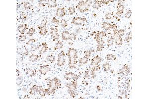Immunohistochemistry (IHC) image for anti-Forkhead Box P1 (FOXP1) (AA 627-677) antibody (ABIN7454010) (Recombinant FOXP1 抗体  (AA 627-677))
