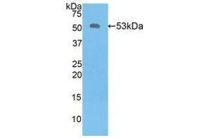 Western blot analysis of recombinant Human KLK6. (Kallikrein 6 抗体  (AA 17-244))