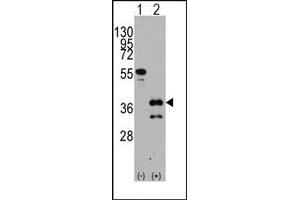 Image no. 1 for anti-Zic Family Member 4 (ZIC4) (C-Term) antibody (ABIN357859) (ZIC4 抗体  (C-Term))