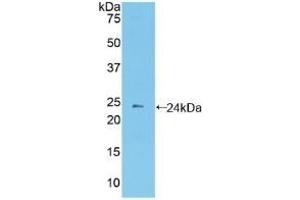 Detection of Recombinant PCDHb2, Mouse using Polyclonal Antibody to Protocadherin Beta 2 (PCDHb2) (PCDHb2 抗体  (AA 79-253))