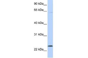CHAC1 antibody used at 1 ug/ml to detect target protein. (CHAC1 抗体)