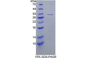 SDS-PAGE (SDS) image for N-Acetyl alpha-D-Glucosaminidase (AA 485-743) protein (His tag) (ABIN3209936)