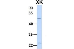 Host:  Rabbit  Target Name:  CHAD  Sample Type:  Human Adult Placenta  Antibody Dilution:  1. (Membrane transport protein XK (XK) (N-Term) 抗体)