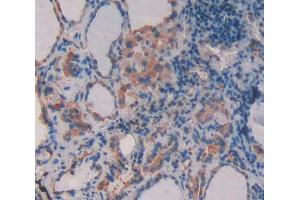 IHC-P analysis of Human Tissue, with DAB staining. (Supervillin 抗体  (AA 1617-1788))
