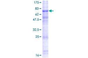 SLC7A11 Protein (AA 1-501) (GST tag)