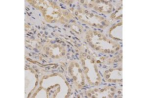 Immunohistochemistry of paraffin-embedded human kidney using ATP6AP1 antibody at dilution of 1:200 (x400 lens). (ATP6AP1 抗体)