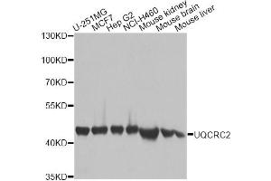 Western blot analysis of extracts of various cell lines, using UQCRC2 antibody. (UQCRC2 抗体)