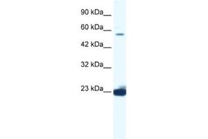 Western Blotting (WB) image for anti-DEAD (Asp-Glu-Ala-Asp) Box Polypeptide 55 (DDX55) antibody (ABIN2461357) (DDX55 抗体)