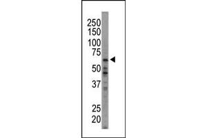 Western blot analysis of anti-HRI Pab (ABIN392638 and ABIN2842142) in  cell lysate.