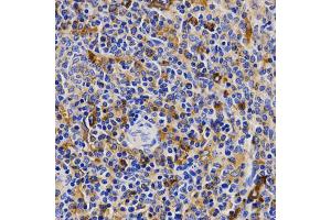 Immunohistochemistry of paraffin-embedded rat spleen using CDK20 antibody (ABIN5971446) at dilution of 1/200 (40x lens). (CCRK 抗体)