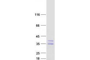 Western Blotting (WB) image for Hydroxyacylglutathione Hydrolase (HAGH) (Transcript Variant 1) protein (Myc-DYKDDDDK Tag) (ABIN2722057)