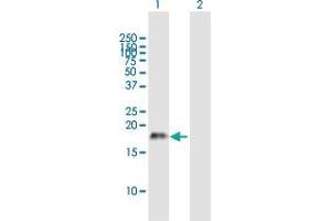 Western Blot analysis of CSF2 expression in transfected 293T cell line by CSF2 MaxPab polyclonal antibody. (GM-CSF 抗体  (AA 1-144))