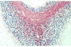 Anti-Myelin Basic Protein antibody IHC of human myelin. (MBP 抗体  (AA 82-87))