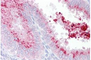 Anti-KIAA1324 antibody IHC staining of human uterus. (ELAPOR1 抗体  (C-Term))