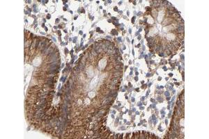 Cytochrome c Antibody for IHC in human colorectal tissue