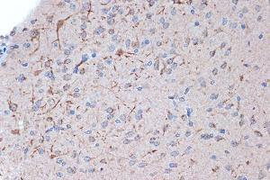 Immunohistochemistry of paraffin-embedded rat brain using Syntenin Rabbit mAb (ABIN7270680) at dilution of 1:100 (40x lens). (SDCBP 抗体)