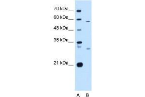 Western Blot showing CD36 antibody used at a concentration of 1-2 ug/ml to detect its target protein. (CD36 抗体)