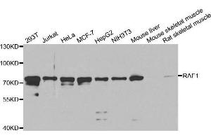 Western Blotting (WB) image for anti-V-Raf-1 Murine Leukemia Viral Oncogene Homolog 1 (RAF1) (AA 190-350) antibody (ABIN3020713) (RAF1 抗体  (AA 190-350))