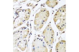 Immunohistochemistry of paraffin-embedded human stomach using HNRNPL antibody. (HNRNPL 抗体  (AA 282-589))