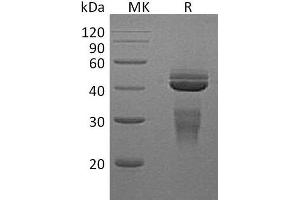 Western Blotting (WB) image for Interleukin 12 (IL12) protein (His tag) (ABIN7321253) (IL12 Protein (His tag))