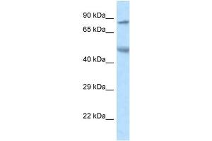 WB Suggested Anti-Zfp90 Antibody   Titration: 1. (ZNF90 抗体  (N-Term))