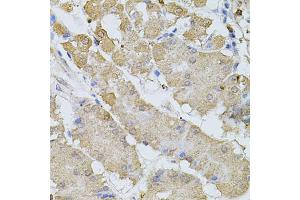 Immunohistochemistry of paraffin-embedded human stomach using BEST1 antibody (ABIN6003520) at dilution of 1/100 (40x lens). (Bestrophin 1 抗体)