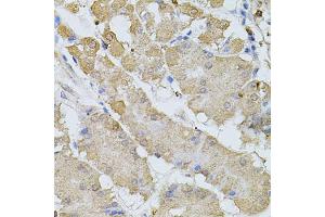Immunohistochemistry of paraffin-embedded human stomach using BEST1 antibody (ABIN6003520) at dilution of 1/100 (40x lens). (Bestrophin 1 抗体)