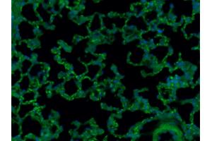 Paraformaldehyde-fixed, paraffin embedded (Mouse lung), Antigen retrieval by boiling in sodium citrate buffer (pH6. (CD8 抗体  (AA 51-150) (Alexa Fluor 488))