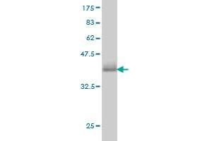 Western Blot detection against Immunogen (36. (CAMK1 抗体  (AA 271-370))