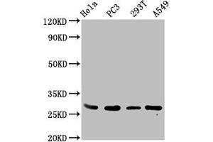 Western Blot Positive WB detected in: Hela whole cell lysate, PC-3 whole cell lysate, 293T whole cell lysate, A549 whole cell lysate All lanes: EFHD1 antibody at 3. (EFHD1 抗体  (AA 15-72))
