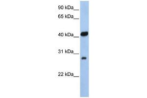Western Blotting (WB) image for anti-Zinc Finger, AN1-Type Domain 3 (ZFAND3) (N-Term) antibody (ABIN1109551)