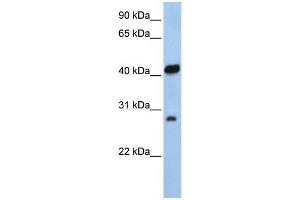 Human 721_B; WB Suggested Anti-ZFAND3 Antibody Titration: 0. (ZFAND3 抗体  (N-Term))