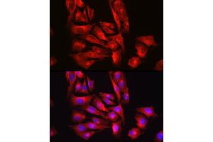 Immunofluorescence analysis of U2OS cells using [KO Validated] Glutathione Synthetase (GSS) Rabbit pAb (ABIN7267451) at dilution of 1:100 (40x lens). (Glutathione Synthetase 抗体  (AA 373-474))