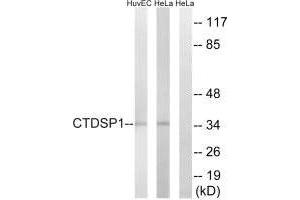 Western blot analysis of extracts from HUVEC cells and HeLa cells, using CTDSP1 antibody. (CTDSP1 抗体  (N-Term))